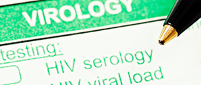 Detail of an HIV Antibody and Viral Load Test. © RapidEye/Eyestockphoto
