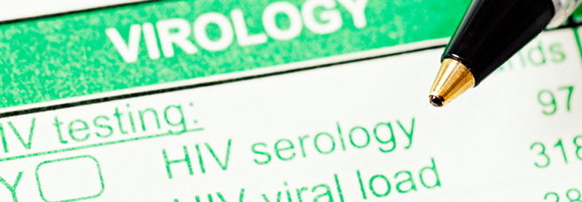 Detail of an HIV Test form. © RapidEye/Eyestockphoto